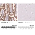 Merck Anti-HSD17B2 antibody produced in rabbit