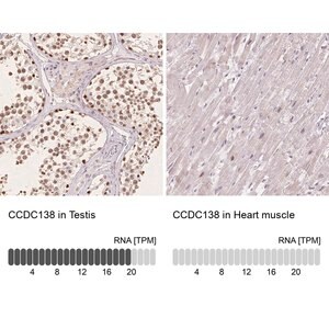 Merck Anti-CCDC138 antibody produced in rabbit
