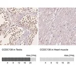 Merck Anti-CCDC138 antibody produced in rabbit