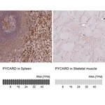 Merck Anti-PYCARD antibody produced in rabbit