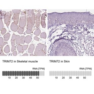 Merck Anti-TRIM72 antibody produced in rabbit