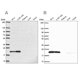 Merck Anti-UBE2M antibody produced in rabbit