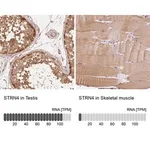 Merck Anti-STRN4 antibody produced in rabbit