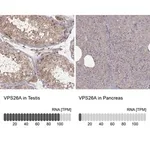 Merck Anti-VPS26A antibody produced in rabbit