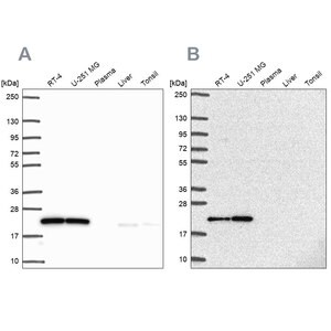 Merck Anti-UBE2M antibody produced in rabbit