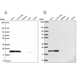 Merck Anti-UBE2M antibody produced in rabbit