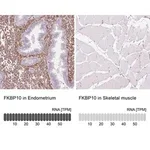 Merck Anti-FKBP10 antibody produced in rabbit
