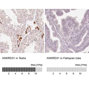 Merck Anti-ANKRD31 antibody produced in rabbit