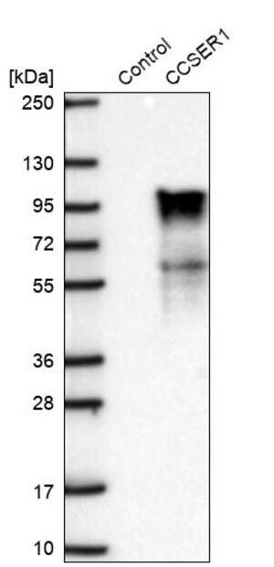 Merck Anti-CCSER1 antibody produced in rabbit