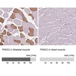 Merck Anti-TNNC2 antibody produced in rabbit