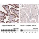Merck Anti-CD2BP2 antibody produced in rabbit
