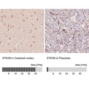 Merck Anti-STK39 antibody produced in rabbit