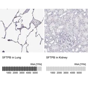 Merck Anti-SFTPB antibody produced in rabbit