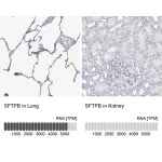 Merck Anti-SFTPB antibody produced in rabbit