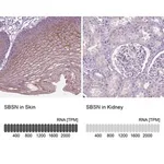 Merck Anti-SBSN antibody produced in rabbit
