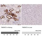 Merck Anti-TMEM72 antibody produced in rabbit