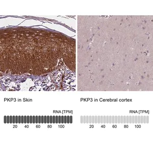Merck Anti-PKP3 antibody produced in rabbit