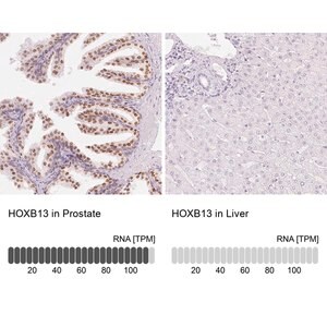 Merck Anti-HOXB13 antibody produced in rabbit