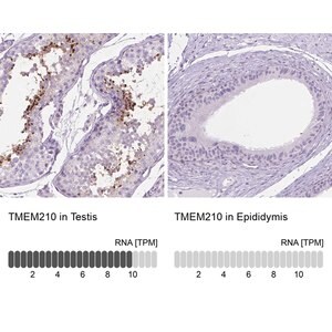 Merck Anti-TMEM210 antibody produced in rabbit