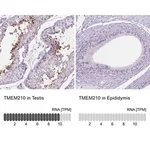 Merck Anti-TMEM210 antibody produced in rabbit