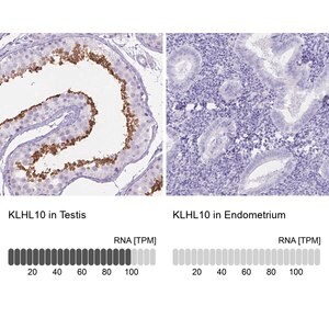 Merck Anti-KLHL10 antibody produced in rabbit