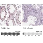 Merck Anti-PIAS2 antibody produced in rabbit