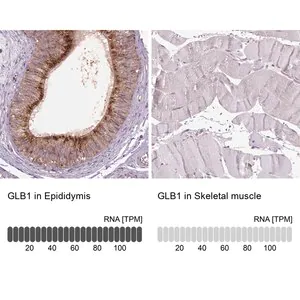 Merck Anti-GLB1 antibody produced in rabbit