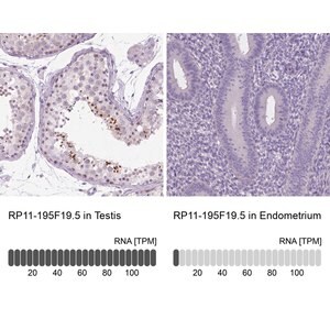 Merck Anti-RP11-195F19.5 antibody produced in rabbit