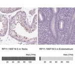 Merck Anti-RP11-195F19.5 antibody produced in rabbit