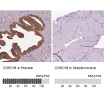 Merck Anti-CORO1B antibody produced in rabbit