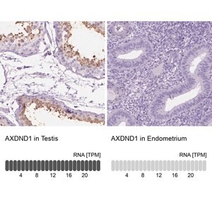 Merck Anti-AXDND1 antibody produced in rabbit
