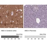 Merck Anti-ABI2 antibody produced in rabbit