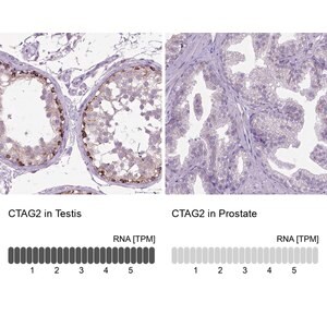 Merck Anti-CTAG2 antibody produced in rabbit