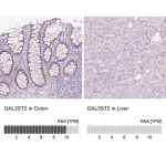 Merck Anti-GAL3ST2 antibody produced in rabbit