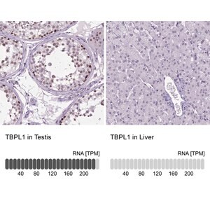 Merck Anti-TBPL1 antibody produced in rabbit