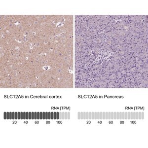Merck Anti-SLC12A5 antibody produced in rabbit