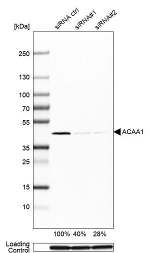 Merck Monoclonal Anti-ACAA1 antibody produced in mouse