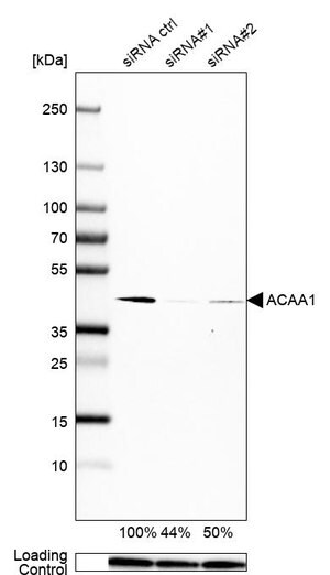 Merck Monoclonal Anti-ACAA1 antibody produced in mouse