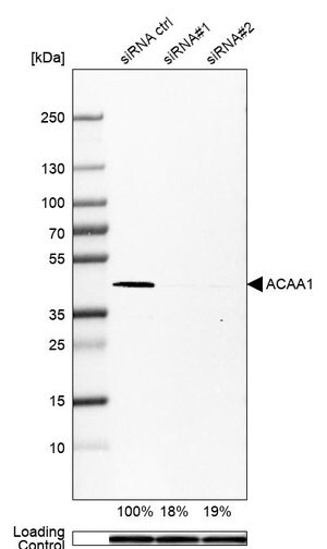 Merck Monoclonal Anti-ACAA1 antibody produced in mouse