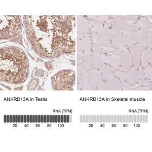 Merck Anti-ANKRD13A antibody produced in rabbit