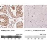 Merck Anti-ANKRD13A antibody produced in rabbit