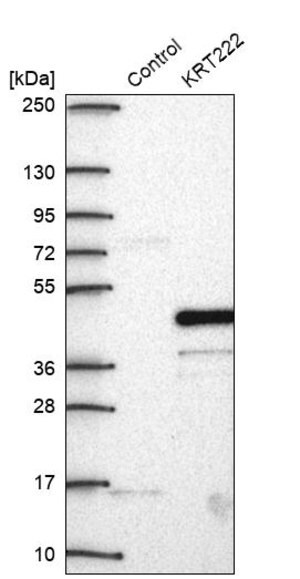 Merck Anti-KRT222 antibody produced in rabbit