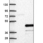 Merck Anti-KRT222 antibody produced in rabbit