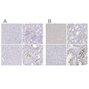 Merck Anti-SPACA1 antibody produced in rabbit