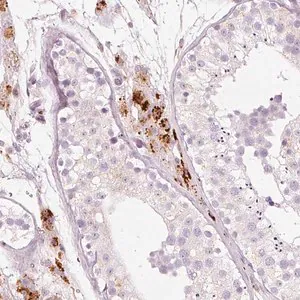 Merck Anti-LECT2 antibody produced in rabbit