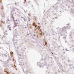 Merck Anti-LECT2 antibody produced in rabbit
