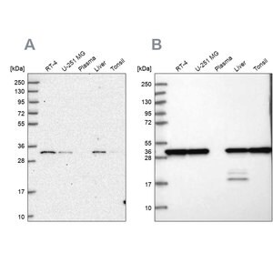 Merck Anti-PSMA1 antibody produced in rabbit