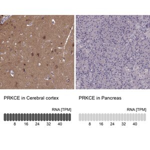 Merck Anti-PRKCE antibody produced in rabbit