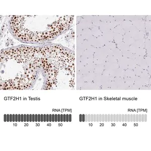Merck Anti-GTF2H1 antibody produced in rabbit