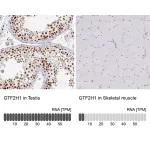 Merck Anti-GTF2H1 antibody produced in rabbit